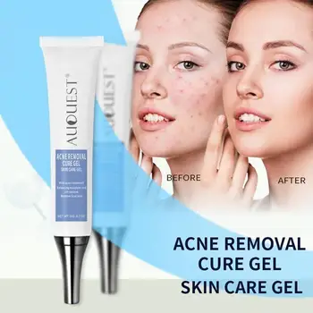 

Scar Marks Acne Treatment Gentle Acne Removal Cure Gel Comedone Pimple Repair Cleaning Cream Beauty Skin Care 20G