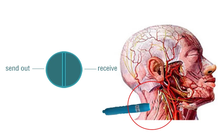 Vascular Doppler- Oxyaider