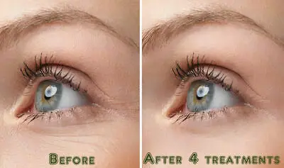 PURE RETINOL витамин а ARBUTIN Matrixyl 3000 против морщин сыворотка для лица 35 мл. Бесплатная