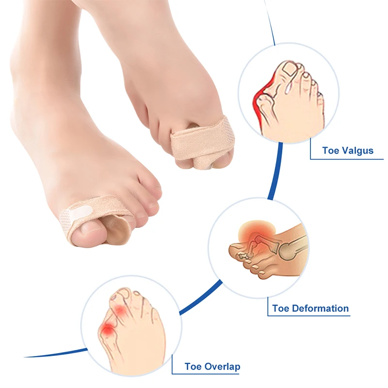 Elino Big Toes Separator Gel Bunion Corrector Bandage Hallux Valgus Toe Protector Foot Bone Straightener Feet Care Tool