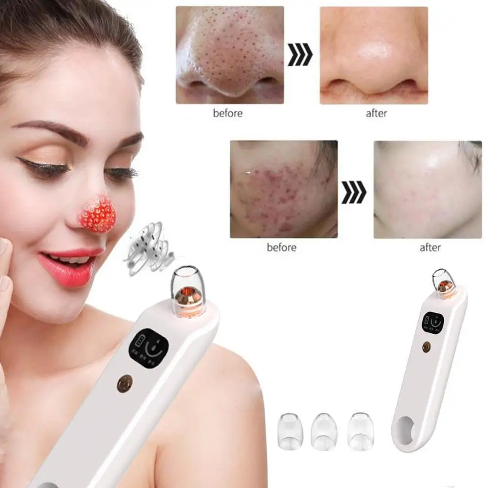 

Face Pimple Acne Comedone Extractor Microdermabrasion Blackhead Remover Vacuum Suction Facial Pores Cleaner Skin Care Tools