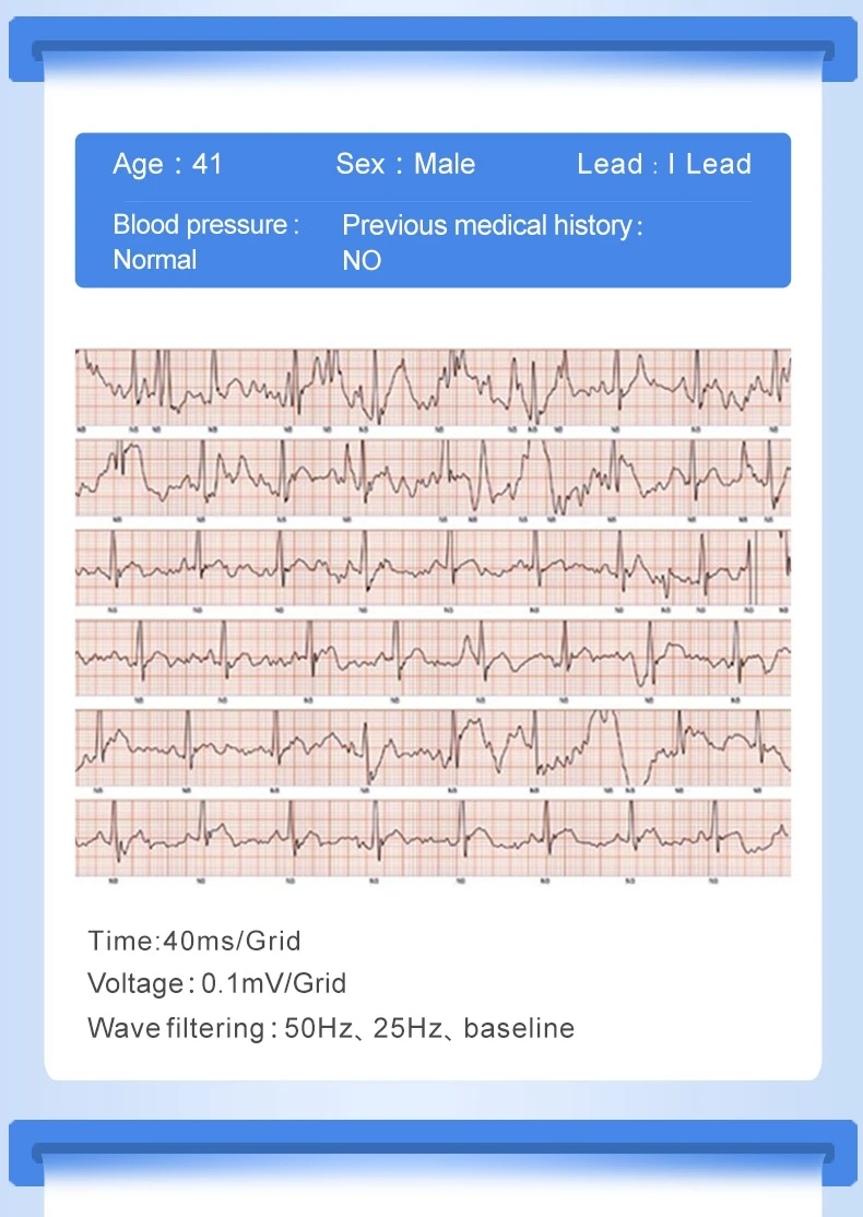 PPG+ ECG P3 Plus Смарт-часы точный монитор сердечного ритма монитор кровяного давления отчет о погоде браслет pk Fitbits android IOS