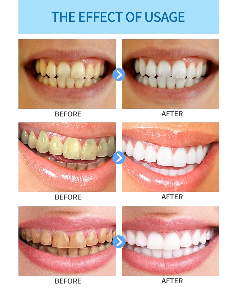 琼-牙粉美白详情_07