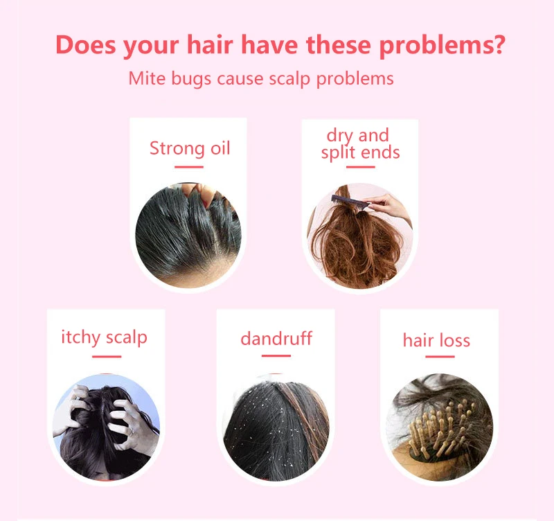 Handmade Anti Dandruff Hair Shampoo Soap Natural Plant Essence Fragrance Shampoo Soap Oil-control Cleaning Smooth Hair Shampoos Handmade Anti Dandruff Hair Shampoo Soap Natural Plant Essence Fragrance Shampoo Soap Oil-control Cleaning Smooth Hair Shampoos