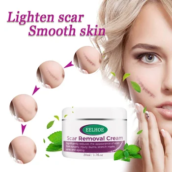 comprar 30/50ml Cicatriz Reparação Creme Faca Reparação Cicatriz Acne Estiramento Marca Creme Escalda Pomada Acne Tratamento De Ponto Clareamento Gel