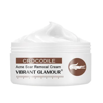 

Crocodile Repair Face Cream Acne Scar Removal Whitening Spot Stretch Treatment