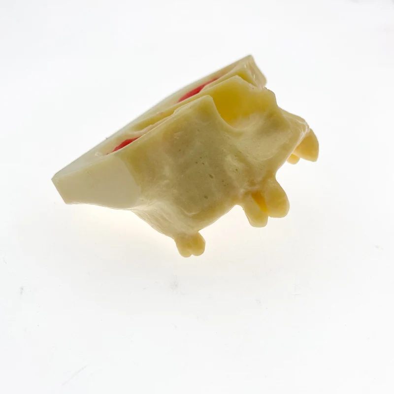 Стоматологическая модель зубов для тренировок при подъеме Модель обучения