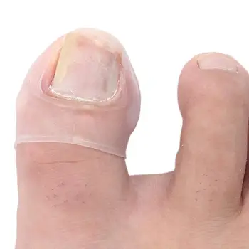 

Ingrown Armor Elastic Patch Sticker Straightening Clip Toe Treatment Correction Pedicure Toenail Nail Tool Tool Brace Ingro D1B3
