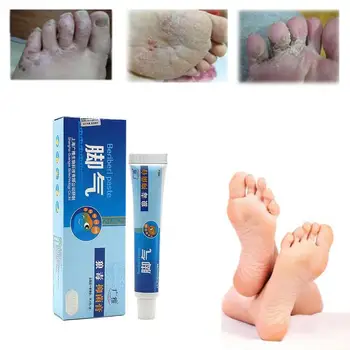 

20g Athlete's Foot Ointment Anti-Fungal Foot Cream Beriberi Treatment Feet Care Foot Odor Smelly Sweat Itching Ringworm Remove