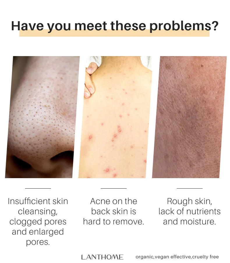 Anti-acne Turmeric Soap Cleans Skin Remove Mites Shrink Pores For Bath Handmade Natural Skin Whitening Soap Anti-inflammatory