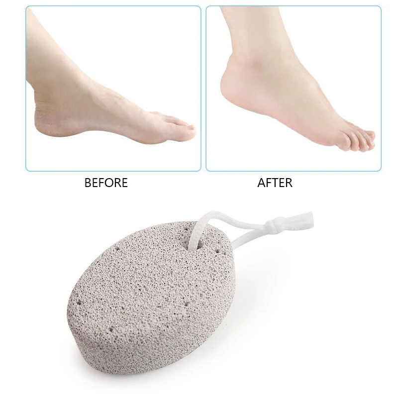 

Pumice Stone Remove Dead Skin Calluses Foot Volcanic Stone Foot File Skin Care Tool Good Use E1