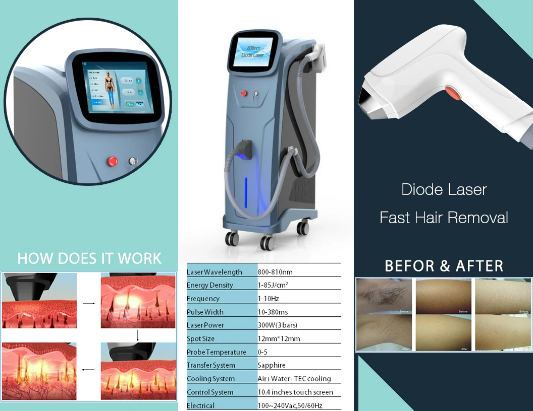 WAESEN диодный лазер 808nm машина удаления волос терапия для лица, рук, подмышек, груди, спины, бикини, ног