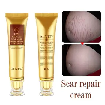 

30g Remove Acne Scar Treatment Cream Face Whitening Scar Nourish Repair Cream Pimple Body Skin Postpartum Pregnancy