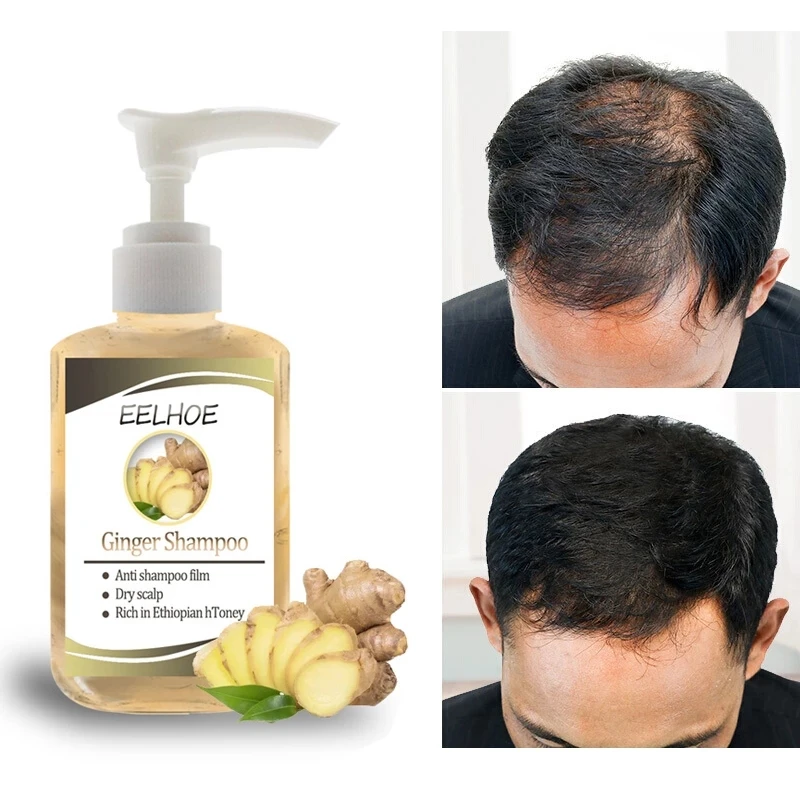 Ginseng-Anti-Haarausfall-Shampoo-Leistungsstarke-Behandlung-Haarpflege-Wachstum-Essenz-Kr-uter-Ingwer-K-hler-Haar-Wachstum.jpg_Q90.jpg_.webp (3)