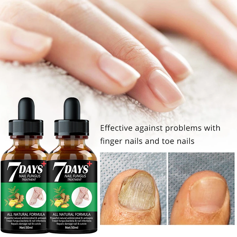 Nail Fungus Treatment Essence Serum Care Hand and Foot Care Removal Repair Gel Anti-infective Paronychia Onychomycosis