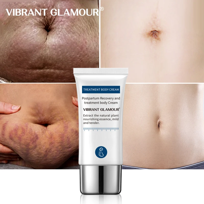 

VIBRANT GLAMOUR Stretch Marks Removal Cream Maternity Repair Scar Natural Mild Non-irritating Abdomen Stretch Marks Remover 30g