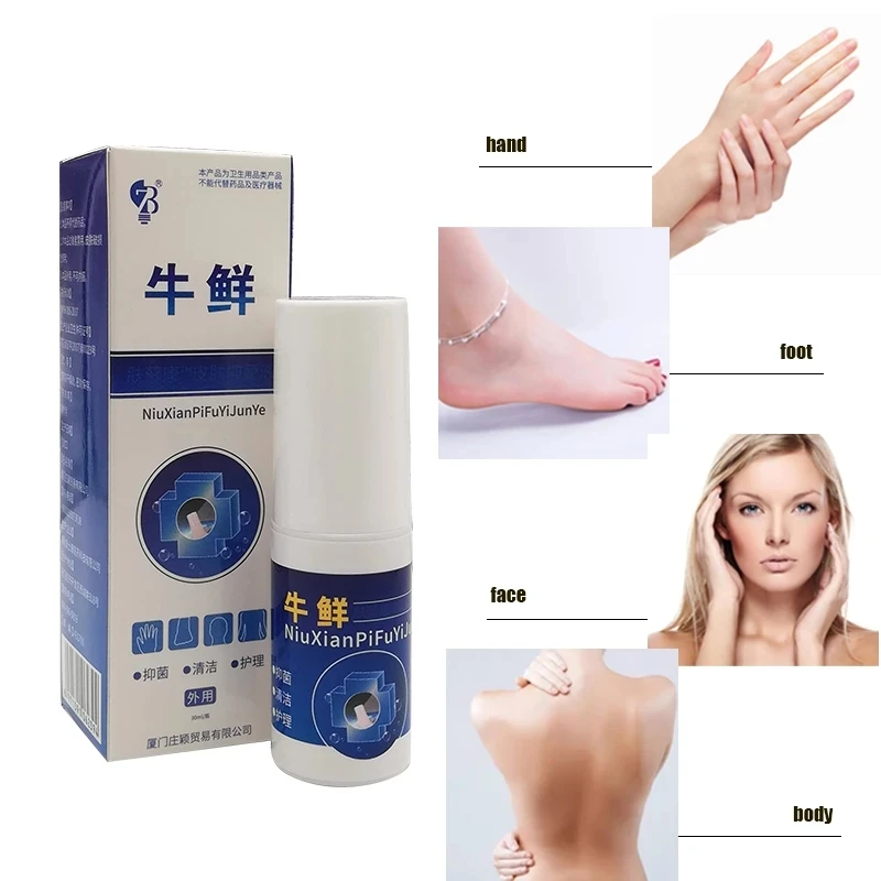Herbal Psoriasis Spray Is Suitable For Various Psoriasis And Eczema Skin Problem Patch Body Massage Antibacterial Cleansing Care