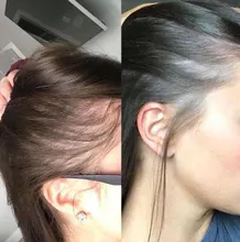 Productos para la pérdida de cabello, Productos naturales sin efectos secundarios para el crecimiento rápido del cabello y el rejuvenecimiento del cabello