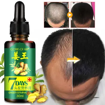 

New 2020 30ML 7 Day Ginger Germinal Serum Essence Oil Natural Hair Loss Treatement Effective Fast Growth Hair Care