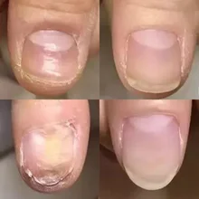 Полезный защитный крем для ногтей, уход за кожей, Лечение грибка ногтей, травяные ногти, восстанавливающий крем, инструменты для ухода за ногтями