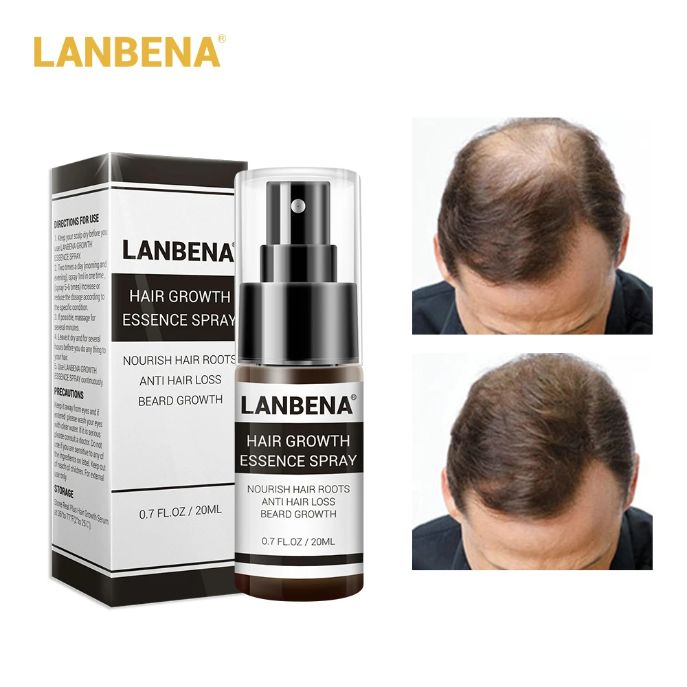 

LANBENA Hair Growth Essence Spray Product Preventing Baldness Consolidating Anti Hair Loss Nourish Roots Hair Care 20ml
