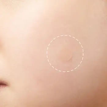 

Invisible Acne Pimple Patches Face Spot Scar Care Treatment Stickers Blemish Acne Remover Face Spot Scar Care Face Makeup