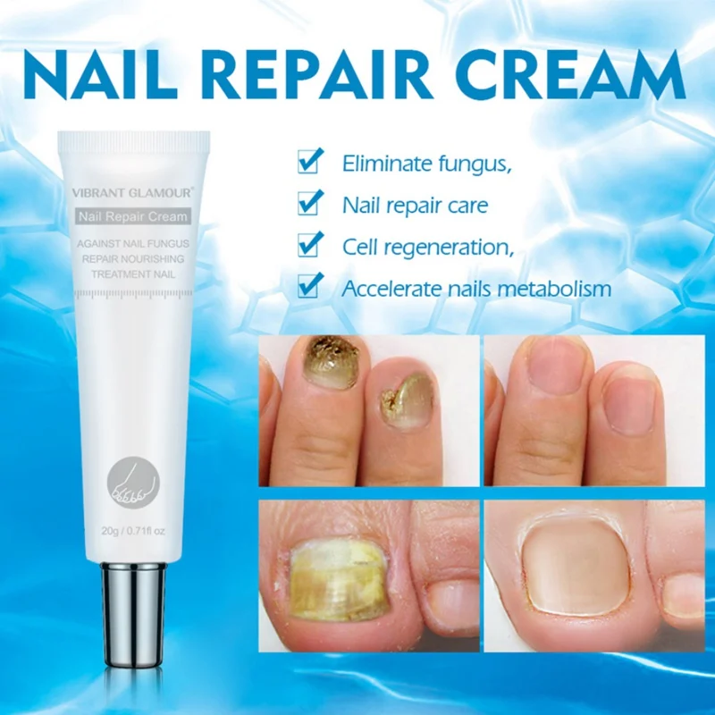 Vitality Nail Repair Nail Polish Fungus Nail Treatment Clear Antifungal