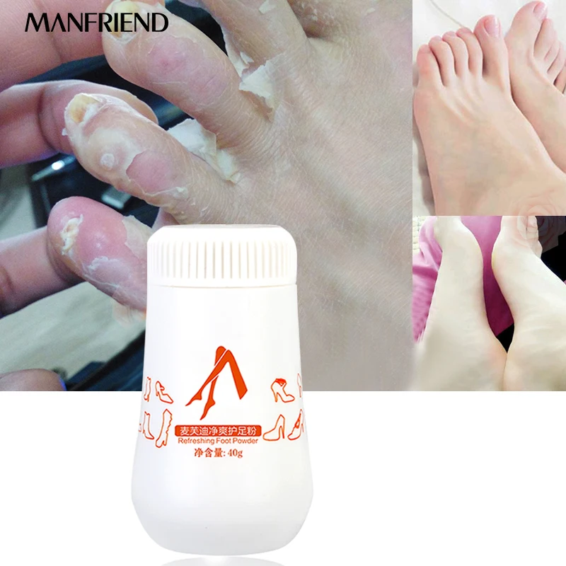 Foot Powder Treatments Solution Foot Odor Foot Sweat Itching Bacteria