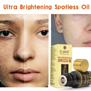

10ml Brightening Spotless Oil Dark Spots Hyper-pigmentation Freckles Solution Brightening Skin Rose Essential oil D0