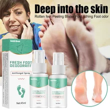 

30ml Foot Odor Spray Effective Anti Fungal Spray for Cracked Heel Peeling Blister Repairing Moisturizing Foot Care