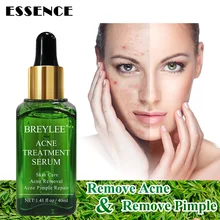 Лучшая анти акне эссенция для удаления прыщей ремонт усадка поры уход за кожей лица 40 мл QQ99