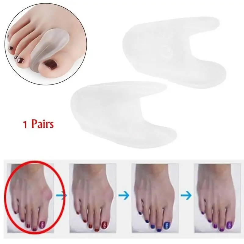 1 Pair A-Shaped Splitter SEBS Toe Thumb Valgus Corrector Toe Overlap Separator Small Toe Correction Stretcher Straightener