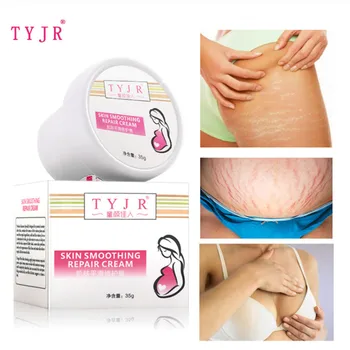 

Effectively Repair Stretch Marks Removal Remover Plant Natural Heal Pregnancy Breast Hip Legs Stretch Mark Cream