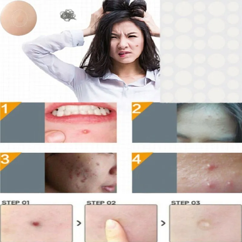 Ярлык кожи и патчи от акне красоты акне наклейки водный гель от акне и ...