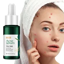 

Acne Serum Moisturizing Soothes Redness Swelling Repair Fades Acne Marks Shrink Pores Nourish Brighten Skin Colour Face Care