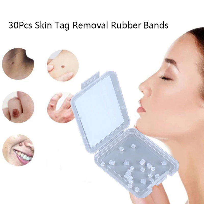 5box Skin Tag Removal Rubber Bands 48mm Non Toxic Face Care Mole Wart Tool 2021新入荷