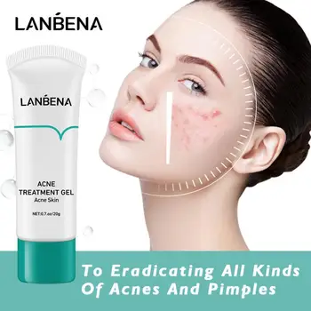 

LANBENA Pimple Acne Treatment Cream Plants Essence Anti Acne Serum Shrink Pore Scar Removal Moisturizing Whitening Face Cream