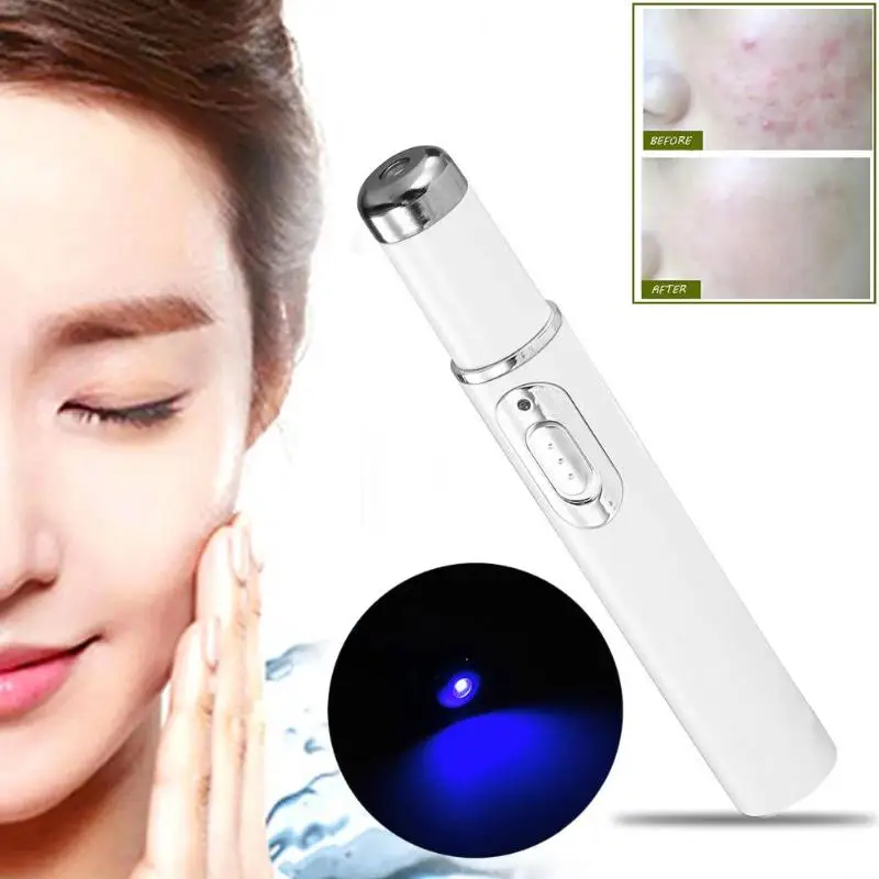 Blue Light Laser Pen Scar Acne Removal Therapy Portable Wrinkle Beauty Device 415nm | Красота и здоровье