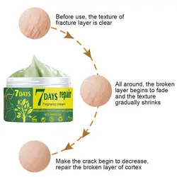 Stretch Removal Natural Extracts Easy to Absorb Scar Remove Cream Pregnancy Repair Cream for Mother Skin for Mother