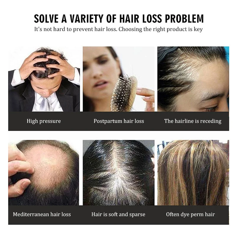 Hair Growth Vitamin Biotin Pills Hair Care Anti-hair Loss Multiple Vitamin Supplements Men And Women Health Products