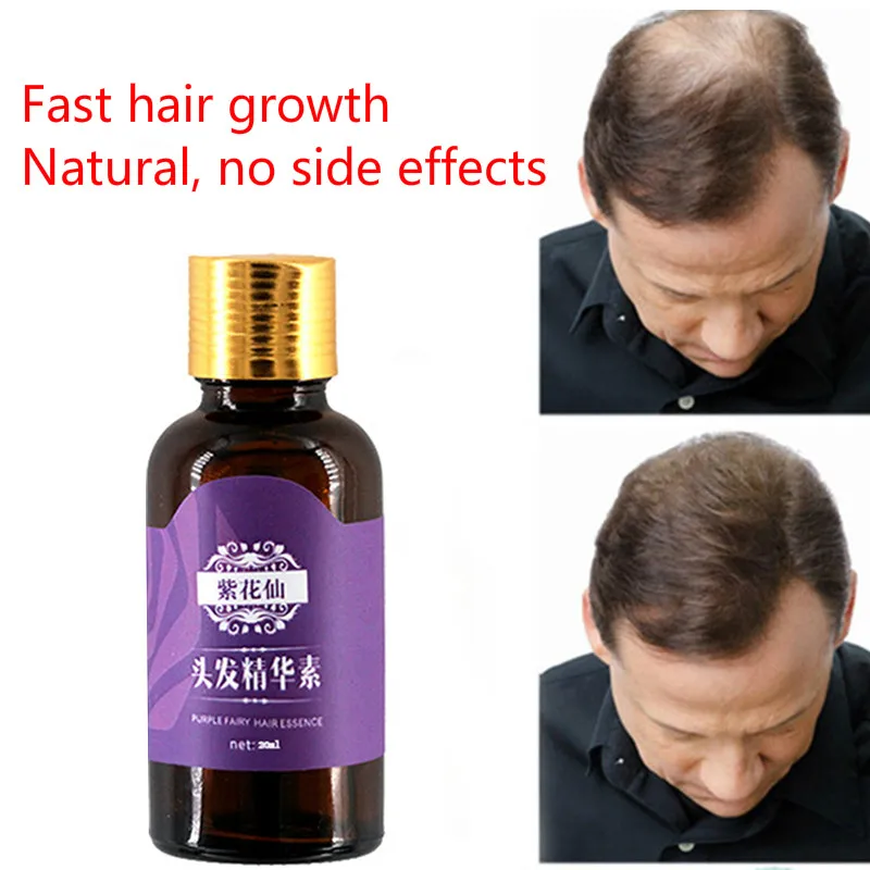 Эффективное восстанавливающее эфирное масло для волос, которое позволяет волосам быстрее расти. Продлеваемые длинные волосы натуральные продукты для выпадения волос