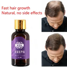 Эффективное восстанавливающее эфирное масло для волос, которое позволяет волосам быстрее расти. Продлеваемые длинные волосы натуральные продукты для выпадения волос