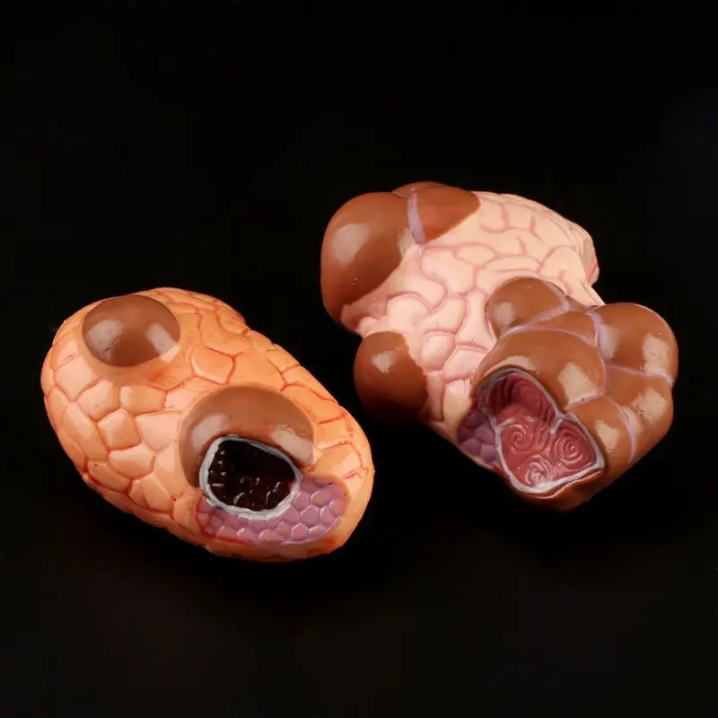 

PVC Human Anatomical Thyroid Gland Pathology Laryngeal Anatomy Teaching Resource Model Educational Props Medical Science