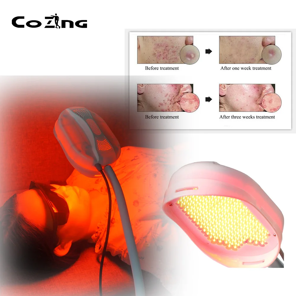 Светодиодный светильник для лечения акне фототерапии уход за кожей омоложения