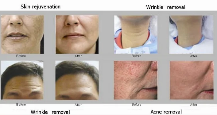 IQY7`XDV[K~`MGN%T_UEW$6