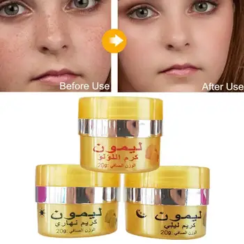 

Effective Lemon Whitening Cream Remove Freckle Melasma Melanin Acne Pigment Care Cream Spots Face N7Y2