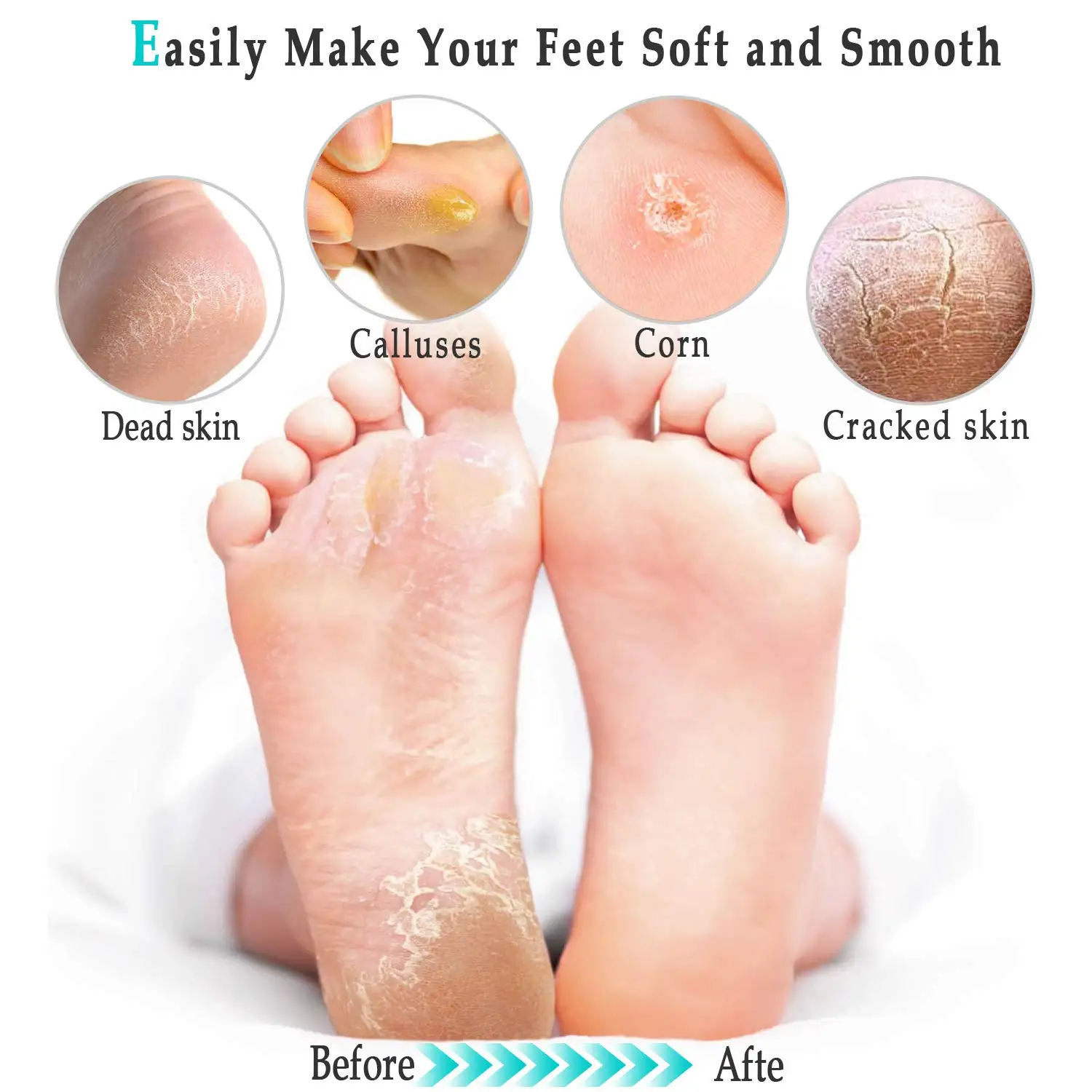 Dropship Electric Foot File Grinder Callus Remover Hard Cracked Dead Dry  Skin Removal Feet Pedicure Tools Rechargeable Foot Care Tool to Sell Online  at a Lower Price