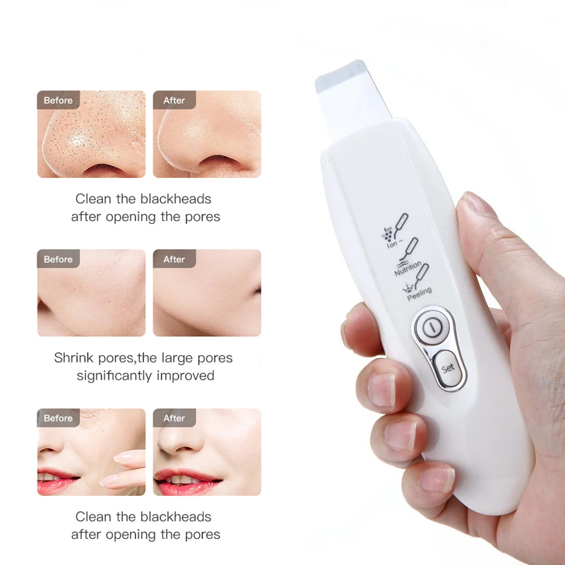 Ultrasonic Skin Scrubber Facial Deep Cleansing Pore Peeling Blackhead Removal Dead Skin Peeling Extractor Face Scrubber Cleanser