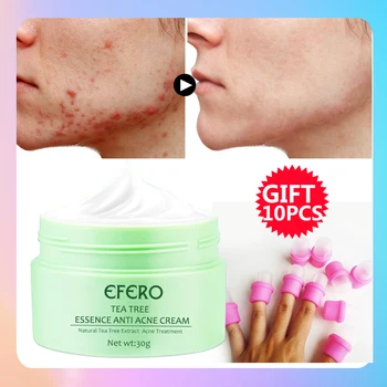 

EFERO Tea Tree Anti Acne Cream Repair Face Cream Hydrating Moisturizer Serum Pimple Acne Treatment Oil Control Shrink Pores