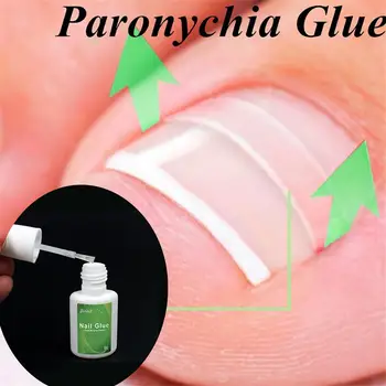 

Professional Toenail Correct Stickers Toenail Fixer Nail Repair Ingrown Toe Straightener Clip Paronychia Care Pedicure Tools